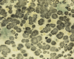 black mold spots